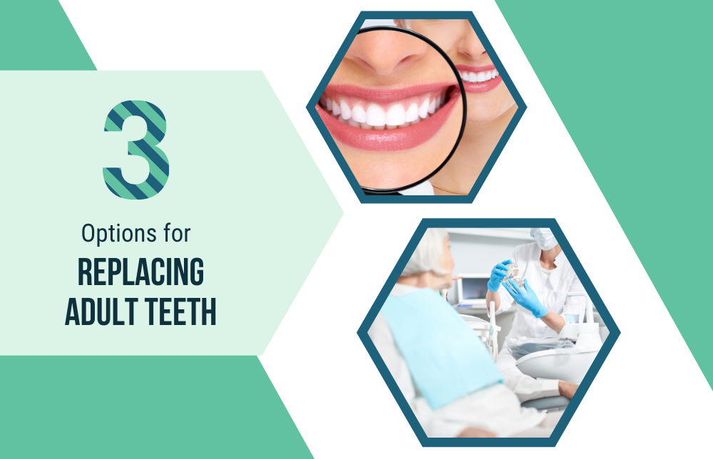 3 Options for Replacing Adult Teeth Image